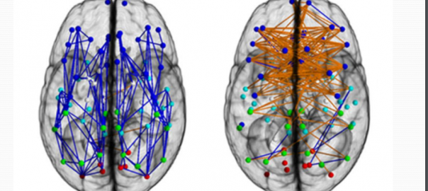 L’estudi sobre les diferències entre el cervell femení i masculí segons ‘Sex differences in the structural connectome of the human brain’