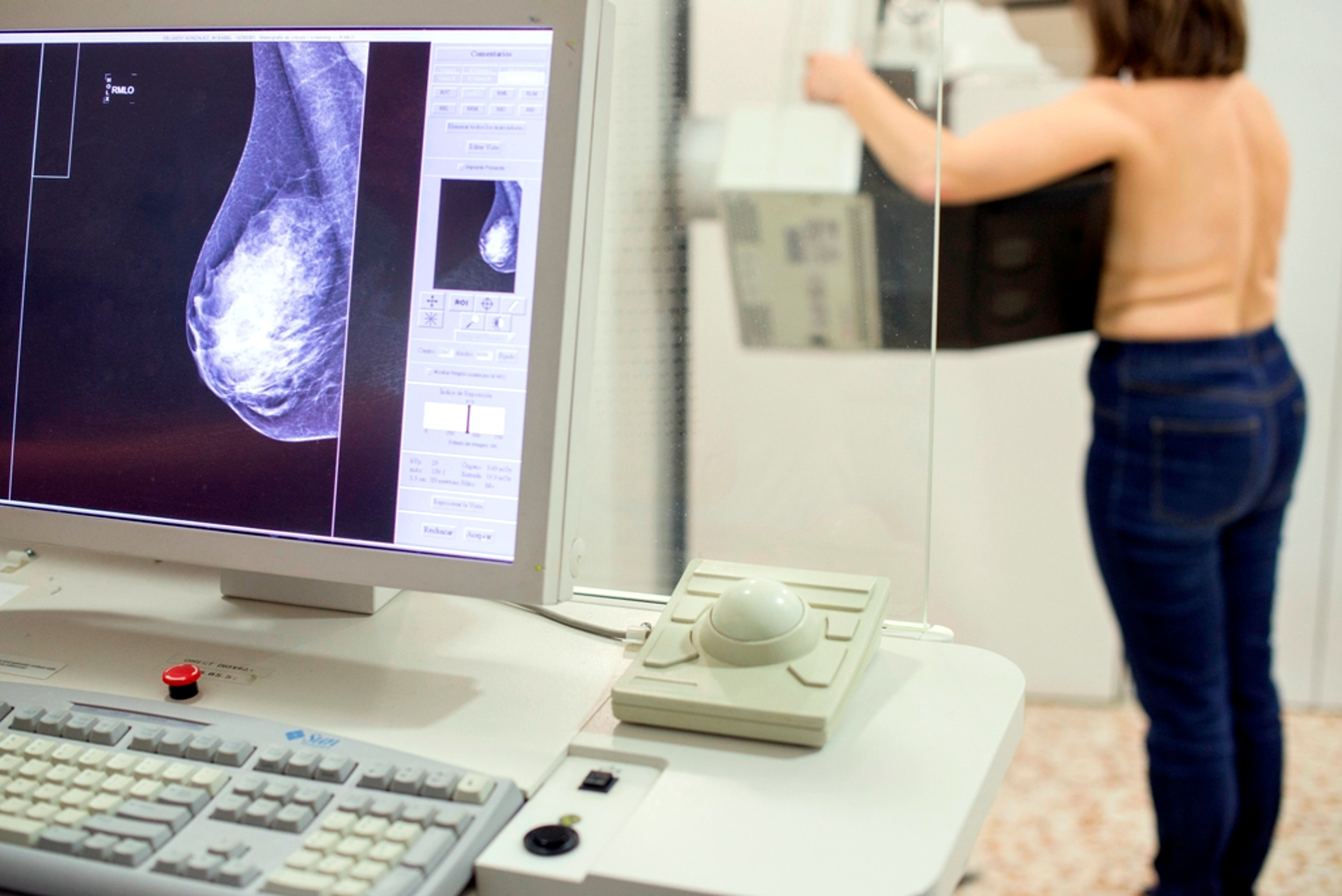 Imatge d'arxiu d'una dona fent-se una mamografia per detectar si té càncer de mama