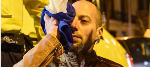 En David, el manifestant que ha perdut parcialment la visió d'un ull a causa de les càrregues policíaques (fotografia: Carles Miró).