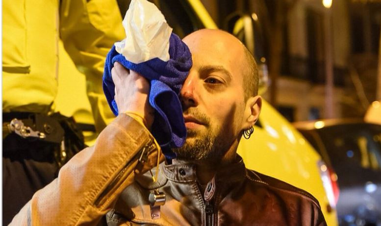 En David, el manifestant que ha perdut parcialment la visió d'un ull a causa de les càrregues policíaques (fotografia: Carles Miró).