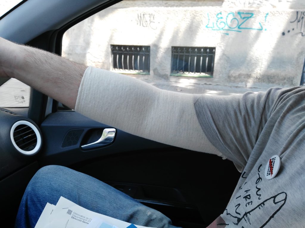 Fotografia de la víctima amb el braç embenat