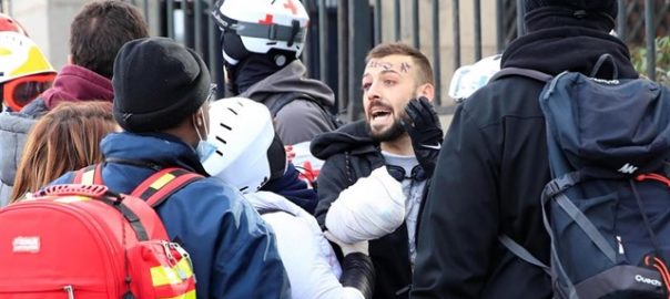armilla groga mà