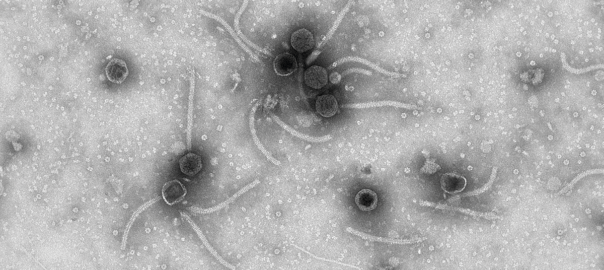 Els bacteriòfags, comunament anomenats fags, són els virus més abundants de la biosfera. S’estima que, per a cada bacteri, hi ha almenys un fag capaç d’infectar-lo. El seu potencial com a eina biomèdica per a tractar infeccions bacterianes obre una etapa prometedora en l’era dels bacteris multiresistents.