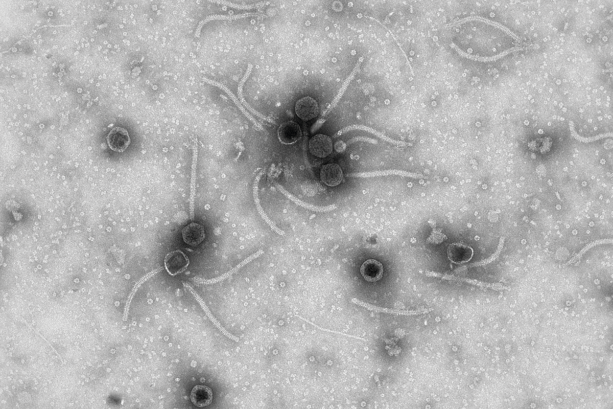 Els bacteriòfags, comunament anomenats fags, són els virus més abundants de la biosfera. S’estima que, per a cada bacteri, hi ha almenys un fag capaç d’infectar-lo. El seu potencial com a eina biomèdica per a tractar infeccions bacterianes obre una etapa prometedora en l’era dels bacteris multiresistents.