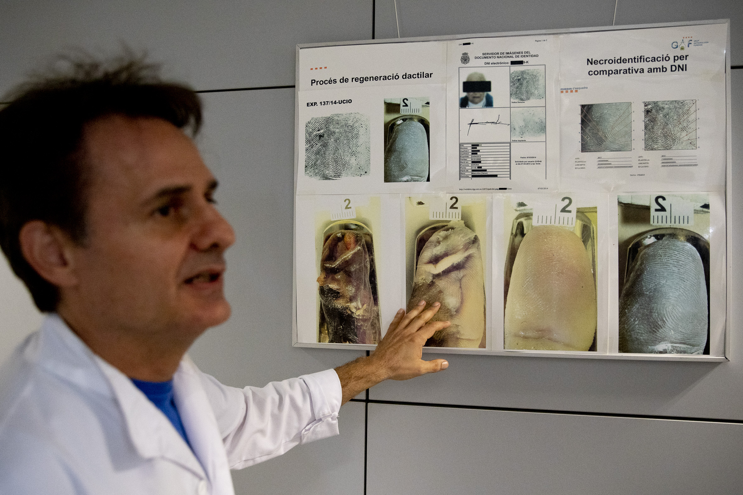 El caporal Daniel Esteban mostrant com es regenera el dit índex, que l'utilitzen per a extreure empremtes (fotografia: Albert Salamé)