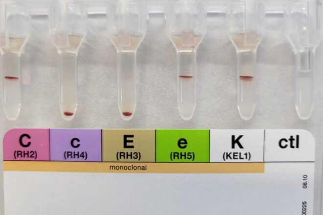 El Banc de Sang genera unes cèl·lules que són l’avantsala per a obtenir glòbuls vermells al laboratori