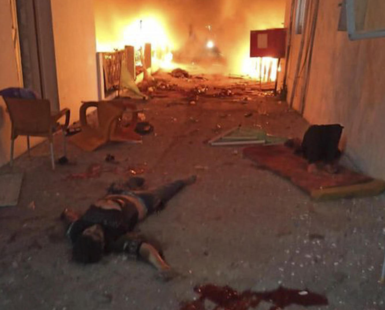 Imatge cedida pel ministeri de Salut palestí