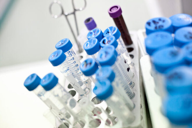 Un nou cas de curació del VIH demostra les possibilitats del trasplantament de cèl·lules mare