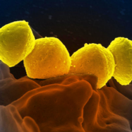 Una infecció rara i mortal és a l’alça al Japó. Què és la STSS?