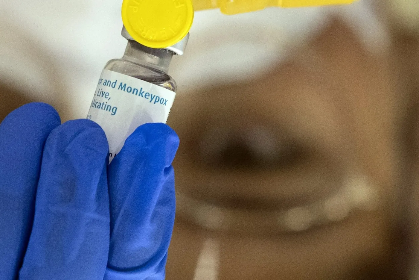 Detall del vaccí de la pigota del mico (fotografia: Étienne Laurent/Efe).