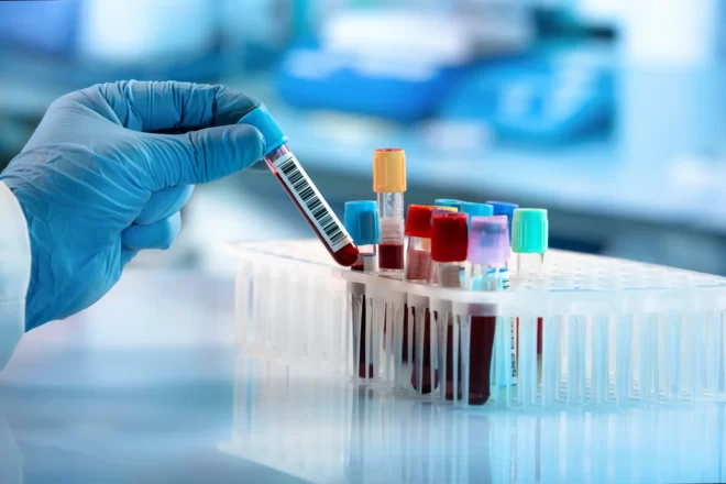 Un nou biomarcador a la sang permet de predir l’Alzheimer en fases molt primerenques