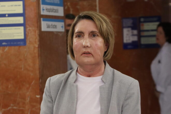 La Vall d’Hebron fa el primer trasplantament de cara del món amb una donant que va rebre eutanàsia