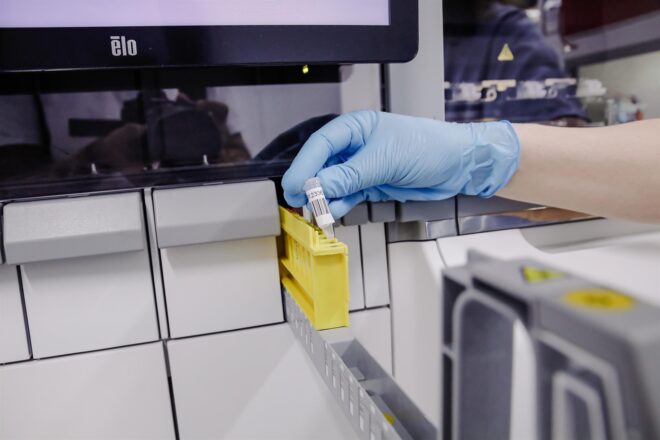 Analitzen la mostra PCR de la dona ingressada a Alacant que va compartir avió amb una víctima d’hantavirus